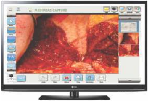 Software of Grossing Workstation